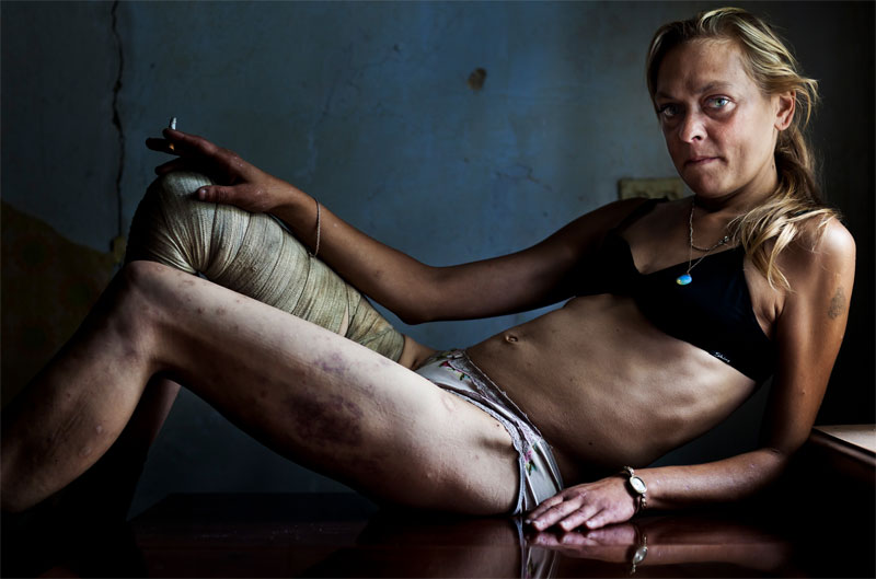 Brent Stirton, Sudàfrica, 1er premi Fotografies individuals Temes contemporanis